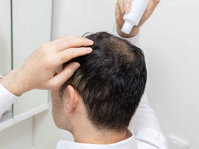 薄毛に予防法はあるの？